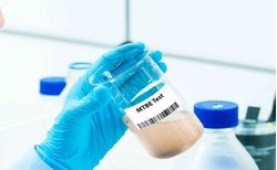 MTBE Market Insights – Regional Price Comparison (June 2025 vs July 2024)